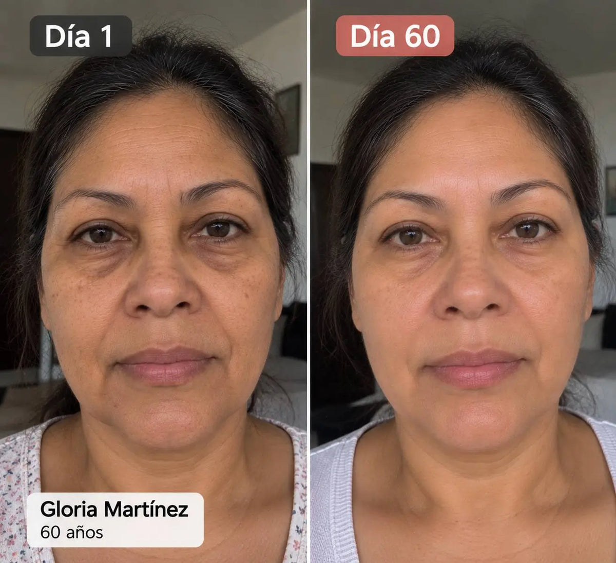 5 EN 1 - SERUM FACIAL
