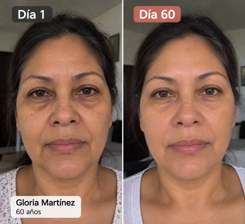 5 EN 1 - SERUM FACIAL